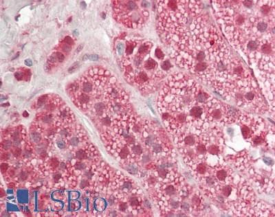 IHC-plus™ Polyclonal Rabbit anti-Human RFX / RFX1 Antibody (IHC, IF, WB)