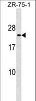 Polyclonal Rabbit anti-Human TMED3 Antibody (aa149-178, WB)