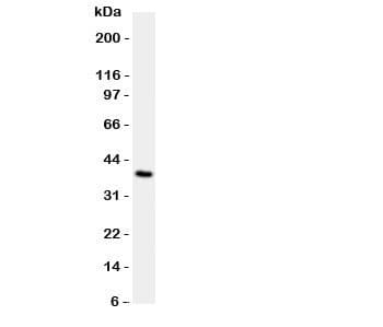 Polyclonal Rabbit anti-Human Collagen III Antibody (aa897-918, WB)