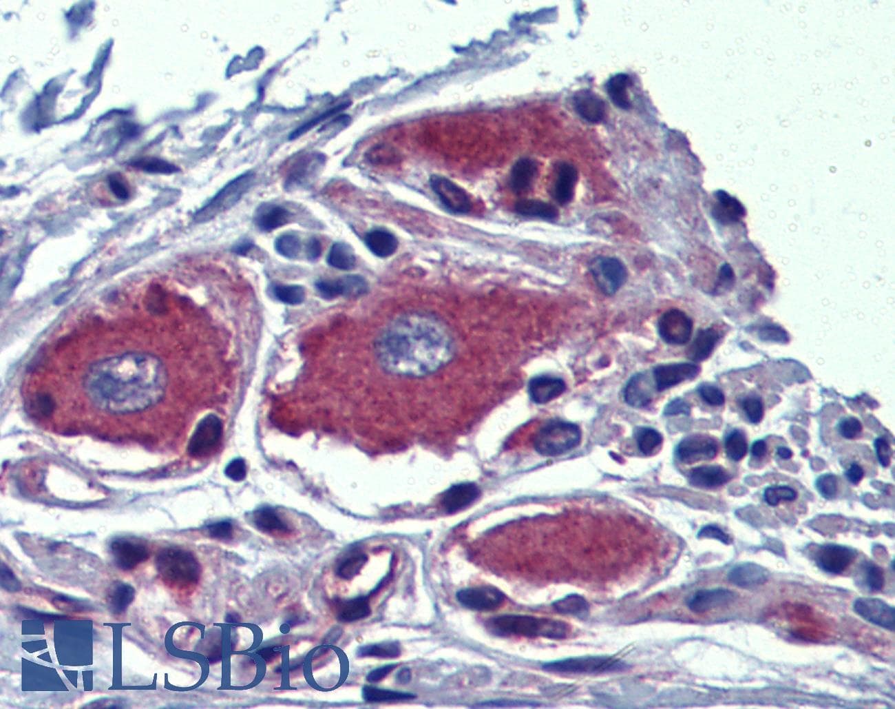 IHC-plus™ Polyclonal Rabbit anti-Human AIPL1 Antibody (IHC, IF, WB)