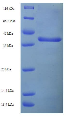 African green monkey CTSL / Cathepsin L Protein (Recombinant His-SUMO)