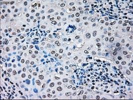 BRAF / B-Raf Antibody (clone OTI1G8)