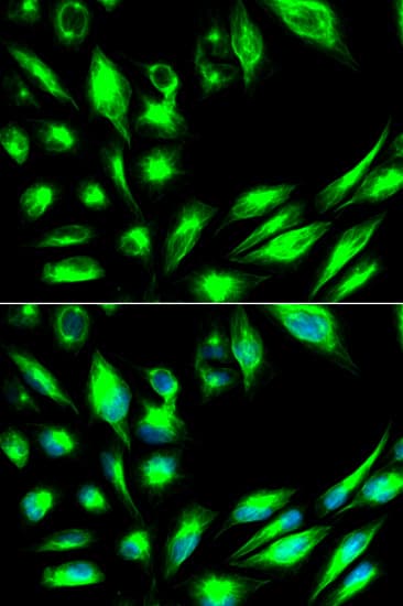 SGK1 / SGK Antibody
