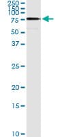 ACS5 / ACSL5 Antibody (clone 5H8)