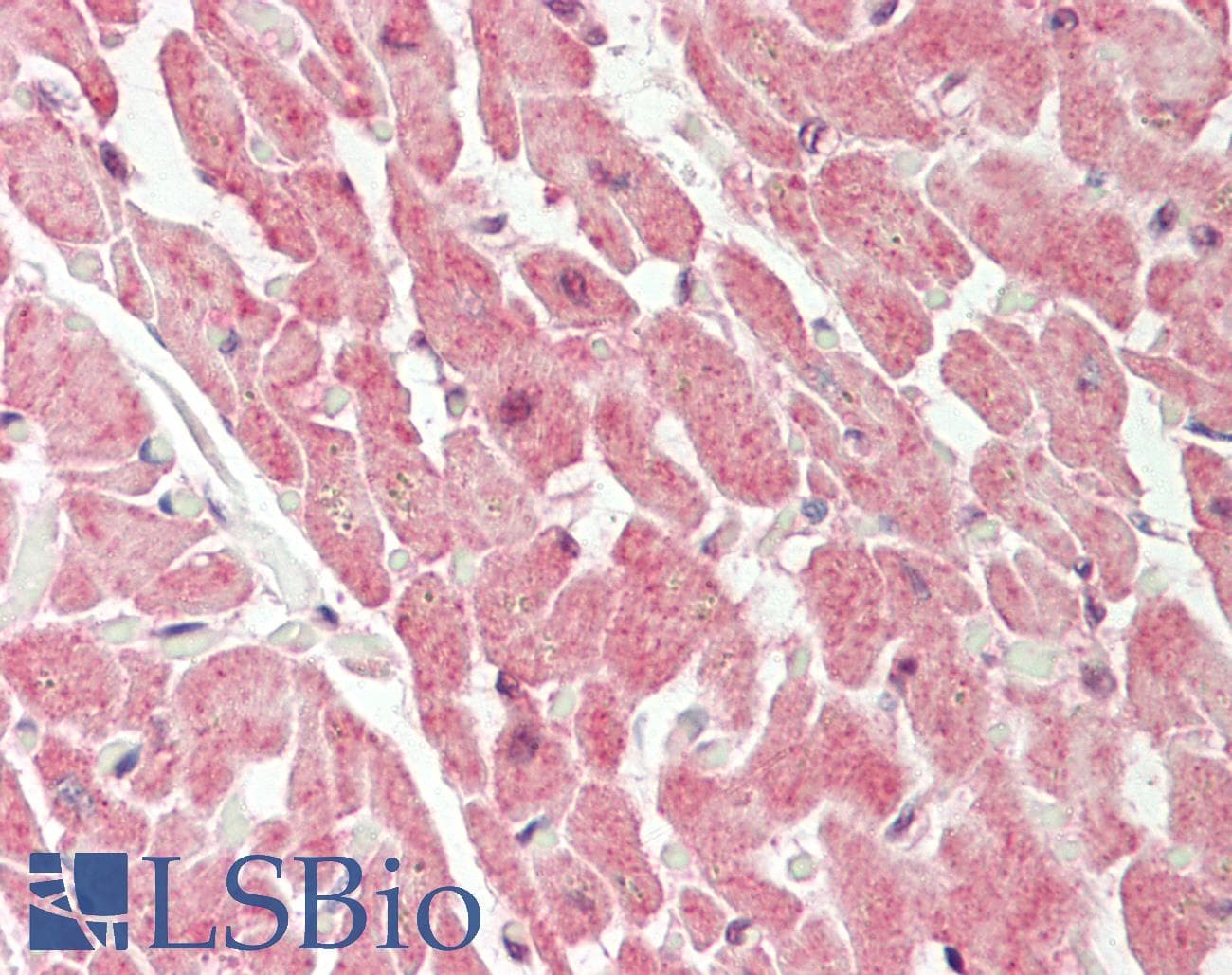 Polyclonal Rabbit anti-Human PYCR1 Antibody (C-Terminus, IHC, WB)