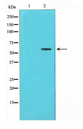 CHEK1 / CHK1 Antibody (phospho-Ser280)