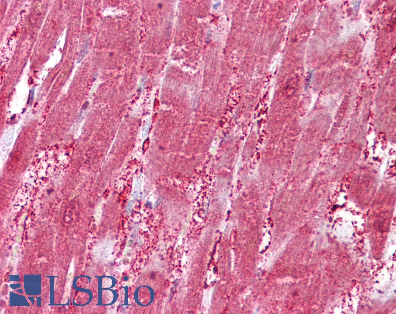 IHC-plus™ Polyclonal Goat anti-Human CSRP3 Antibody (aa150-163, IHC, WB)