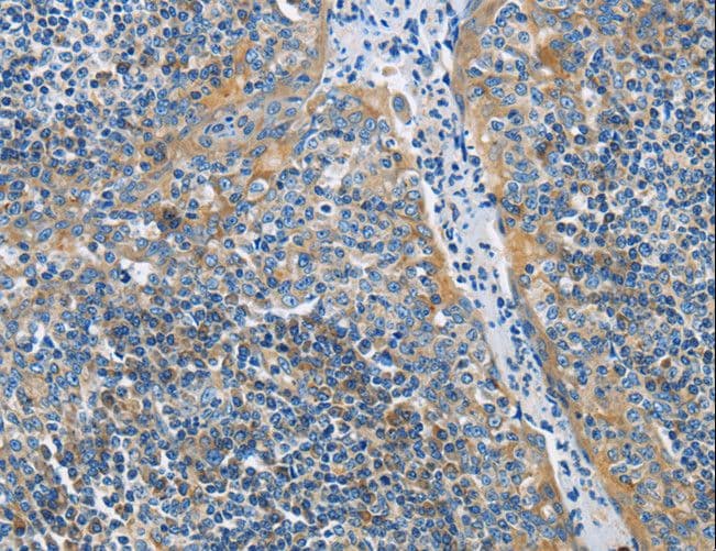 IHC-plus™ Polyclonal Rabbit anti-Human BTLA / CD272 Antibody (IHC)