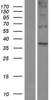 Human TAS2R31 / T2R31 Protein (Over-Expression Lysate Myc-DDK (Flag))