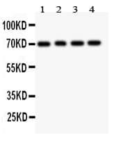 FOXO1 / FKHR Antibody (aa456-655)