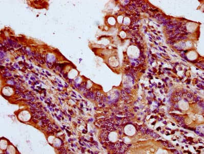 QSOX1 / QSCN6 Antibody