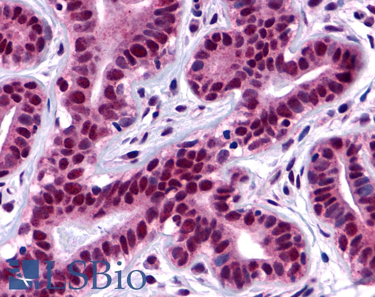 PathPlus™ FAK / Focal Adhesion Kinase Antibody (Internal)