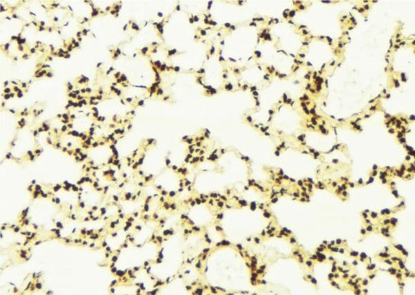 Polyclonal Rabbit anti-Human ELAC2 Antibody (IHC, WB)