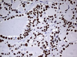 NBN / Nibrin Antibody (aa183-460, clone OTI2F5, Carrier-free)
