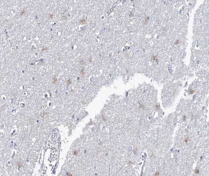 NRG1 / Heregulin / Neuregulin Antibody