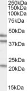 IHC-plus™ Polyclonal Goat anti-Human GABPB1 Antibody (aa198-210, IHC, IF, WB)