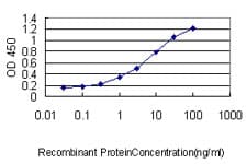 FAM84A Antibody (clone 1C2)
