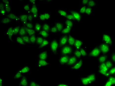 AFF1 / AF4 Antibody