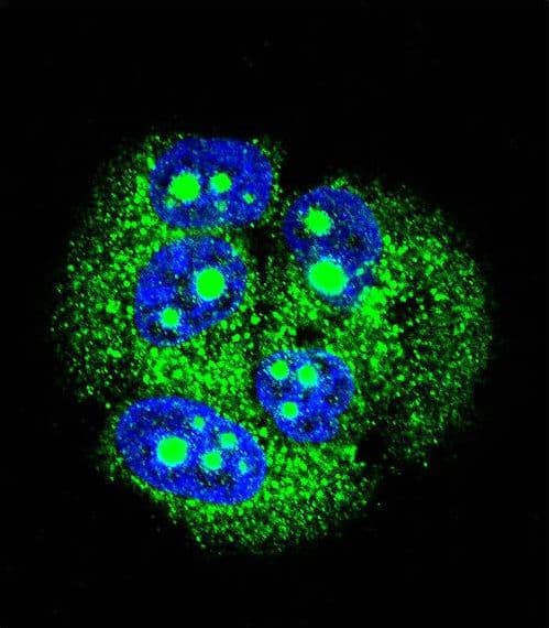 MBD3L3 Antibody (aa156-184)