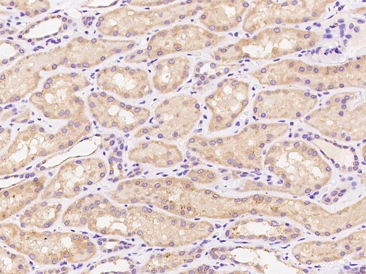 Polyclonal Rabbit anti-Human PPP2R2A Antibody (IHC)