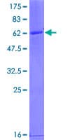 Human DHRSX Protein (Recombinant GST)