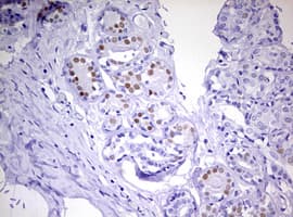 PR / Progesterone Receptor Antibody (aa1-298, clone OTI18B12)