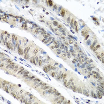 TIA-1 Antibody