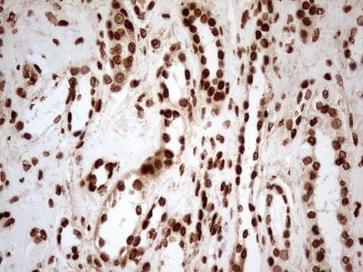 Monoclonal Mouse anti-Human ALOX5 / 5-LOX Antibody (clone OTI3F1, aa18-364, IHC, WB)