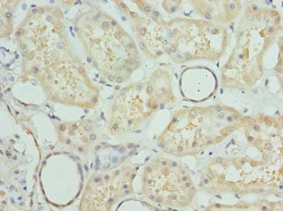 Polyclonal Rabbit anti-Human PRMT6 Antibody (IHC, WB)