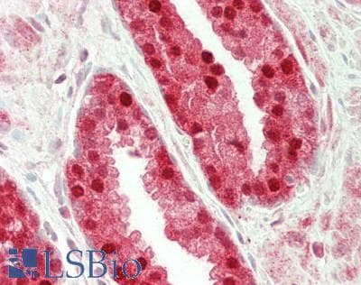 IHC-plus™ ALOX15B / 15-LOX-2 Antibody