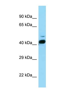RORB / ROR Beta Antibody (aa86-135)
