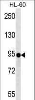 ZNF227 Antibody (aa1-30)