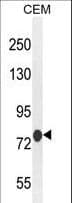 IHC-plus™ Polyclonal Rabbit anti-Human ATF7IP2 Antibody (aa318-347, IHC, WB)