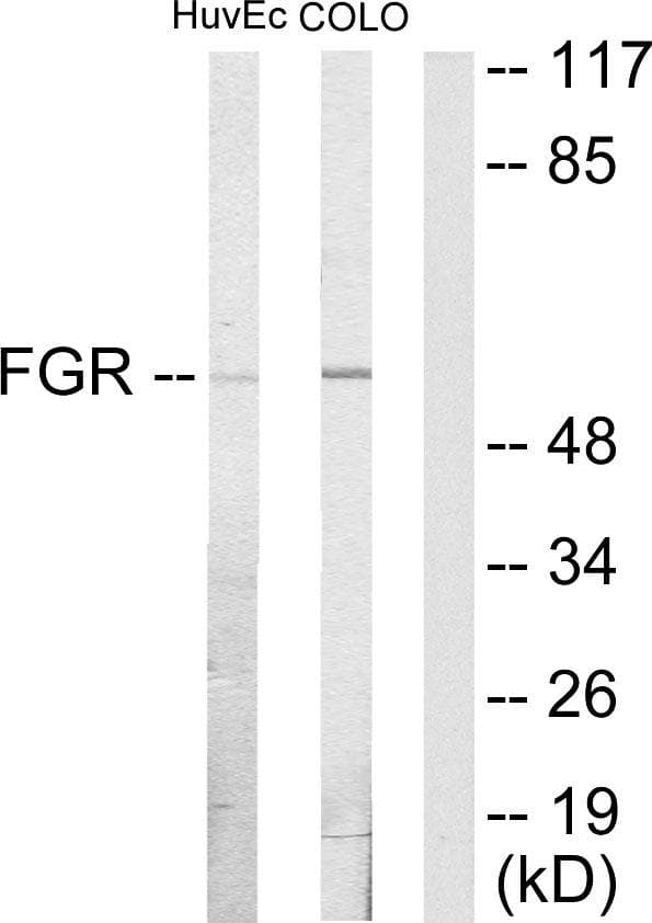 Polyclonal Rabbit anti-Human FGR Antibody (WB)