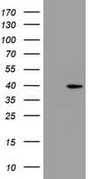PRR11 Antibody (aa125-360, clone OTI5A8, Carrier-free)