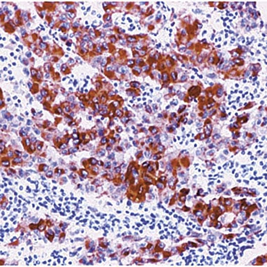 Monoclonal Mouse anti-Human Melanoma Antibody (clone HMB45, IHC, WB)