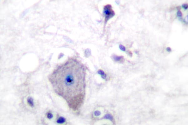 PDGFRA / PDGFR Alpha Antibody (Ser1057)