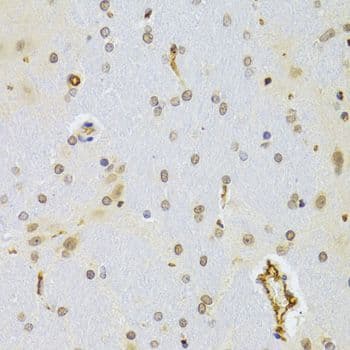 MKI67 / Ki67 Antibody