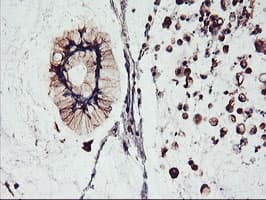 FBXO21 Antibody (clone OTI2C7)