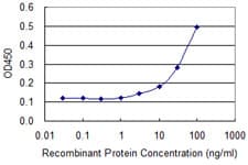 TP53 / p53 Antibody (clone 2C11)