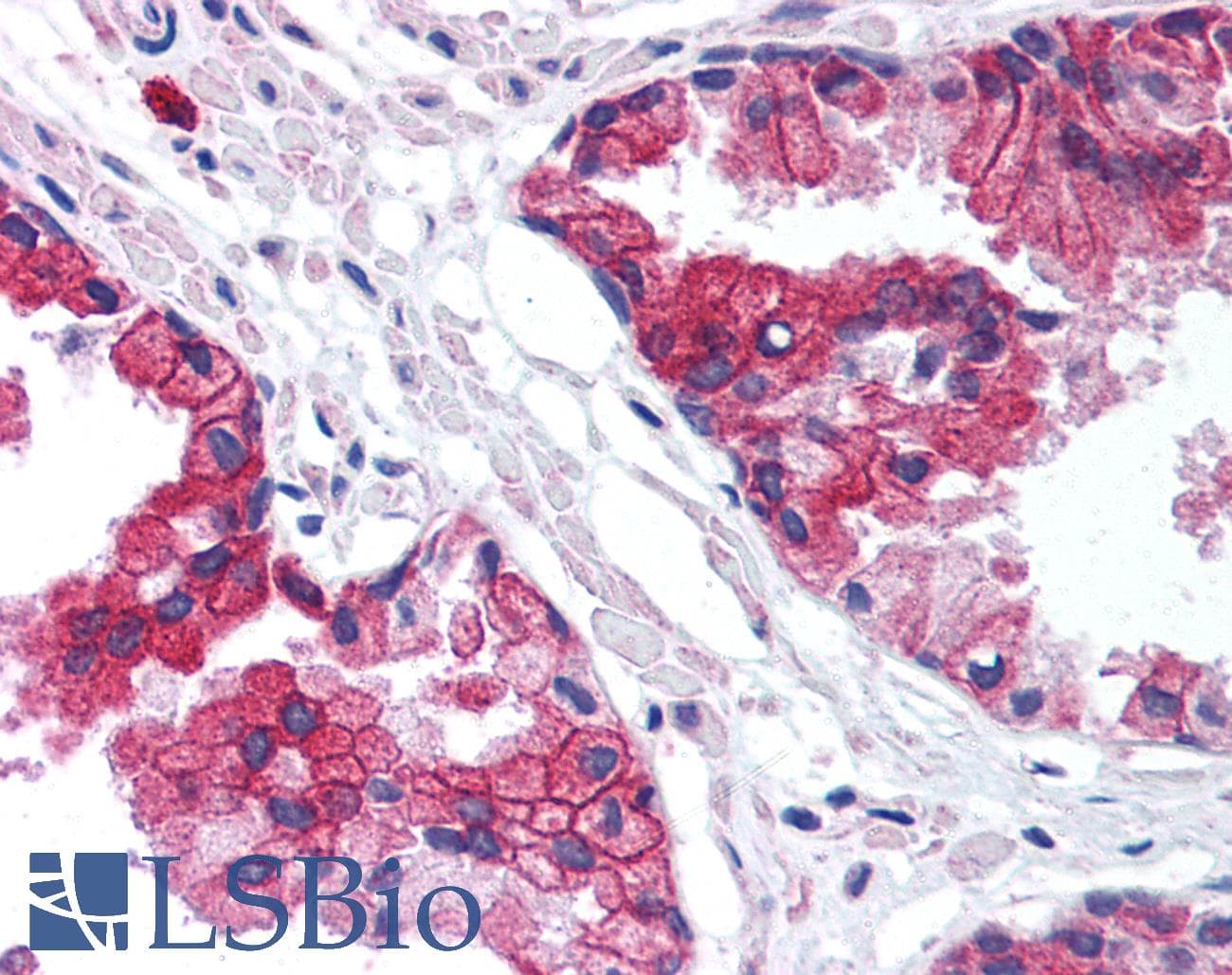 IHC-plus™ TMED10 / TMP21 Antibody