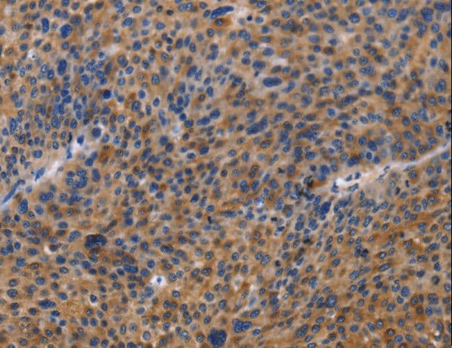 MUSK Antibody