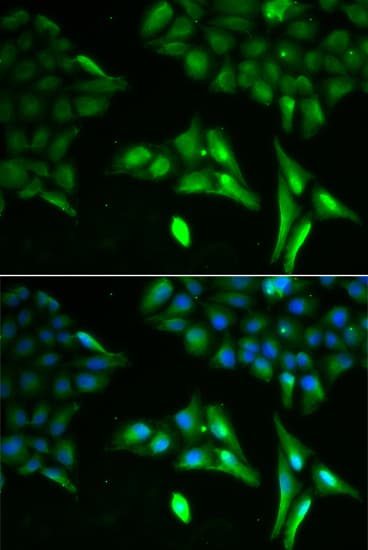 SCAD / ACADS Antibody