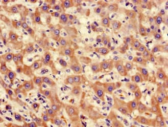 PP2Ac / PPP2CA Antibody