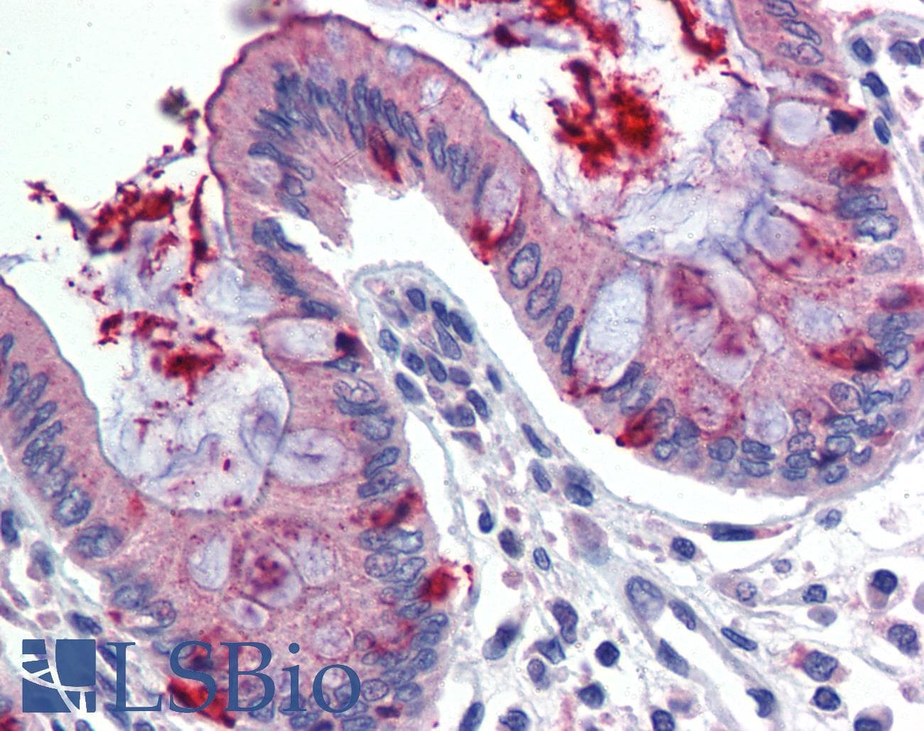 LIN7C / VELI3 Antibody (N-Terminus)