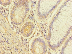 Polyclonal Rabbit anti-Human ALG14 Antibody