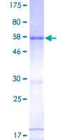 Human RNASEH2A Protein (Recombinant GST)