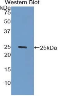 GLB1 / Beta-Galactosidase Antibody (aa68-219)