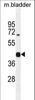 SH2D5 Antibody (aa190-219)