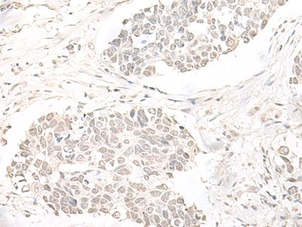 ILKAP Antibody